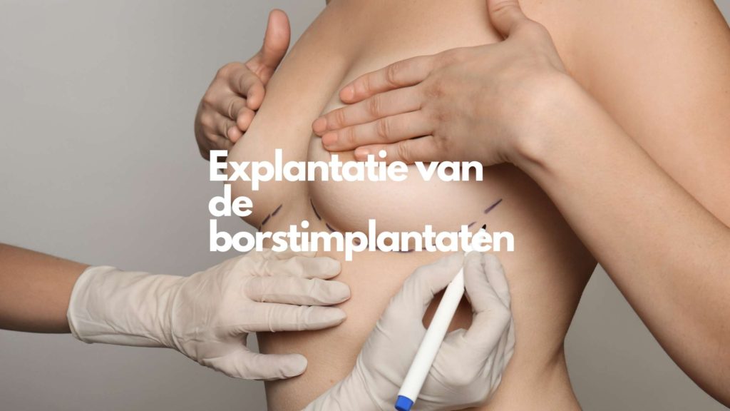 Explantatie borstimplantaten